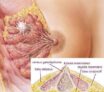 Tumeurs du sein : Anatomie pathologique