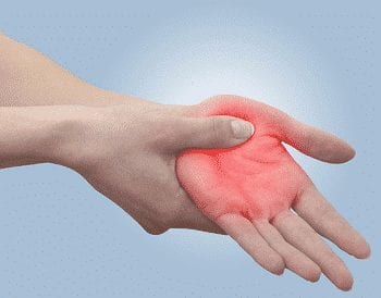 Arthrite