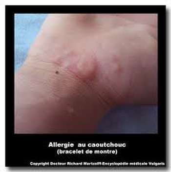 Allergènes