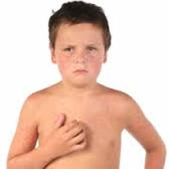 Allergie alimentaire enfant