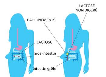 Allergie lactose