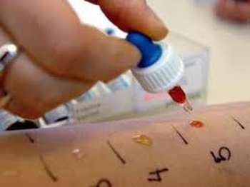 Allergie test