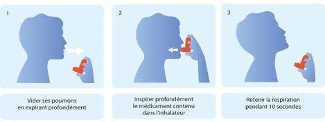 Asthme et traitement
