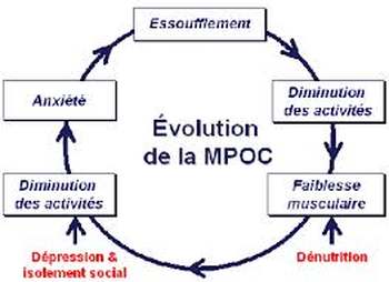 BPCO