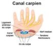 Canal carpien symptomes