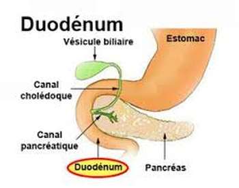 Cancer du duodénum