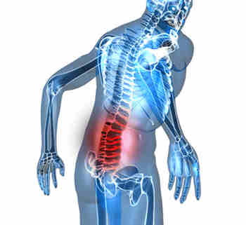 Fibromyalgie