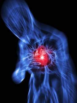 Infarctus