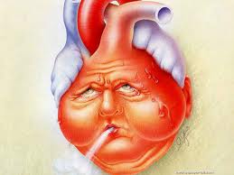 Insuffisance cardiaque