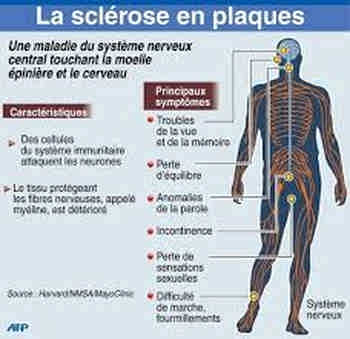 Douleurs oculaires