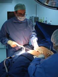 Liposuccion chirurgie