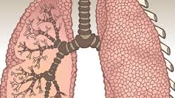 Maladie pulmonaire