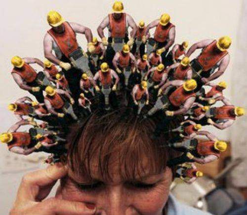 Migraine symptômes