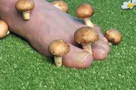 Mycoses