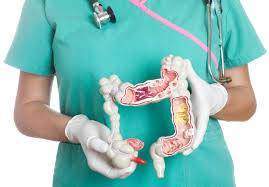 Polypes colon