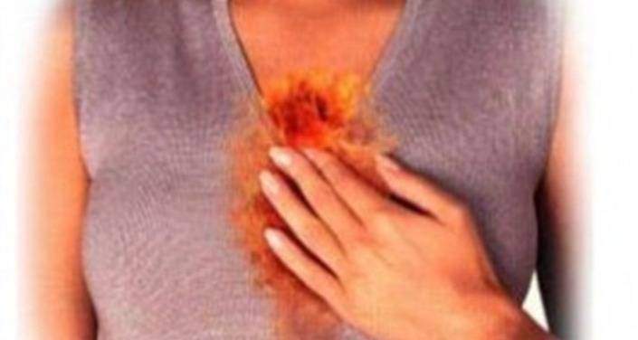 Reflux gastro oesophagien