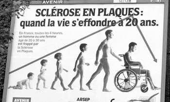 Sclérose en plaques