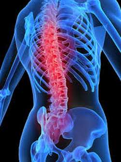 Spondylarthrite ankylosante