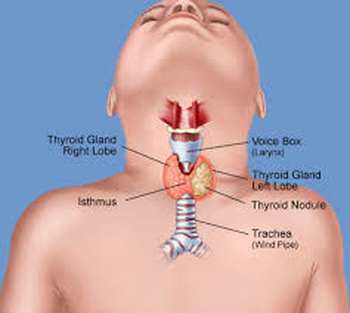 Thyroïde nodules