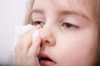 Allergi eige