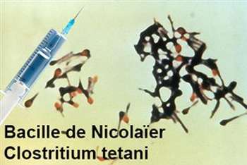Vaccin anti tétanique