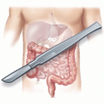 Chirurgie viscerale