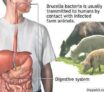 Les infections alimentaires : La brucellose