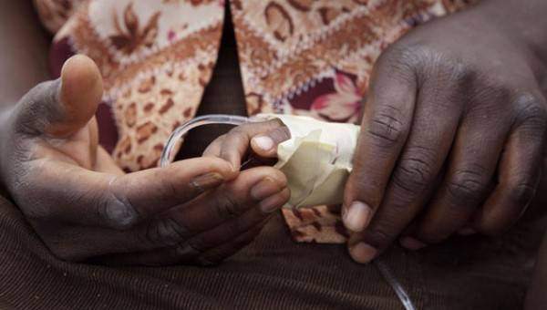 Les infections alimentaires : Le choléra