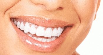 Il faut une bonne mutuelle pour avoir de belles dents