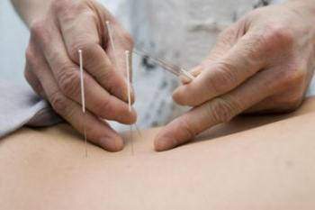 Les indications de l'acupuncture