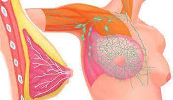 Le cancer du sein : L'hormonathérapie