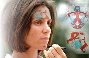 Pathologies diverses: névralgie faciale