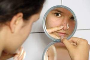 Soins dermatologiques: Acné juvénile