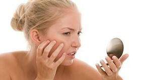 Soins dermatologiques: Acné rosacée