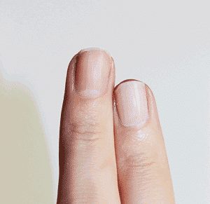 Ongles ternes et cassants