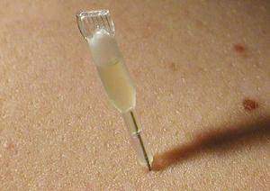 La biomésothérapie et la biomésopuncture