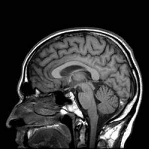 Cerveau sexe et pouvoir : quand l'expérience forge nos têtes