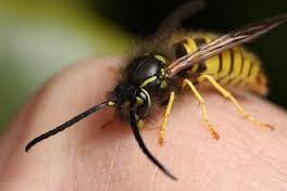 Morsures?piqures,allergies