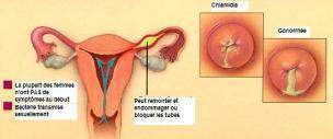 Que sont les pertes vaginales ?