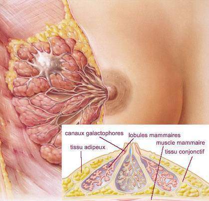 Tumeurs du sein : Anatomie pathologique