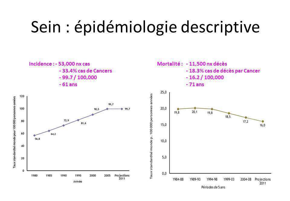 Tumeurs du sein : épidémiologie