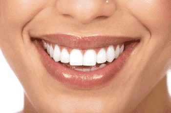 Infarctus: L’importance de l’hygiène buccodentaire