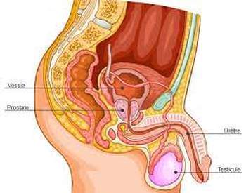 Cancer de la prostate