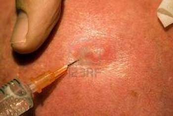 Les cancers, je n’en veux pas