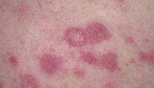 maladies dangereuses