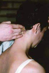 Les pathologies rachidiennes communes
