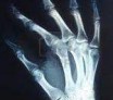 L'imagerie médicale : Des découvertes fondatrices
