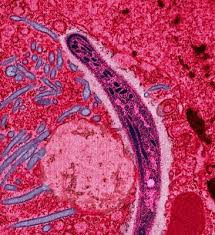 LES INFECTIONS BACTERIENNES ET PARASITAIRES DU FOIE