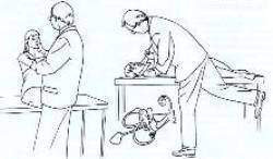 La cupulolithiase