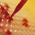 Les analyses biologiques: Gamma Glutamyl Transpeptidase, Glucose